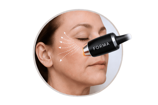 InMode Forma RF treatment for fine lines and reduced skin elasticity around the eyes and cheeks