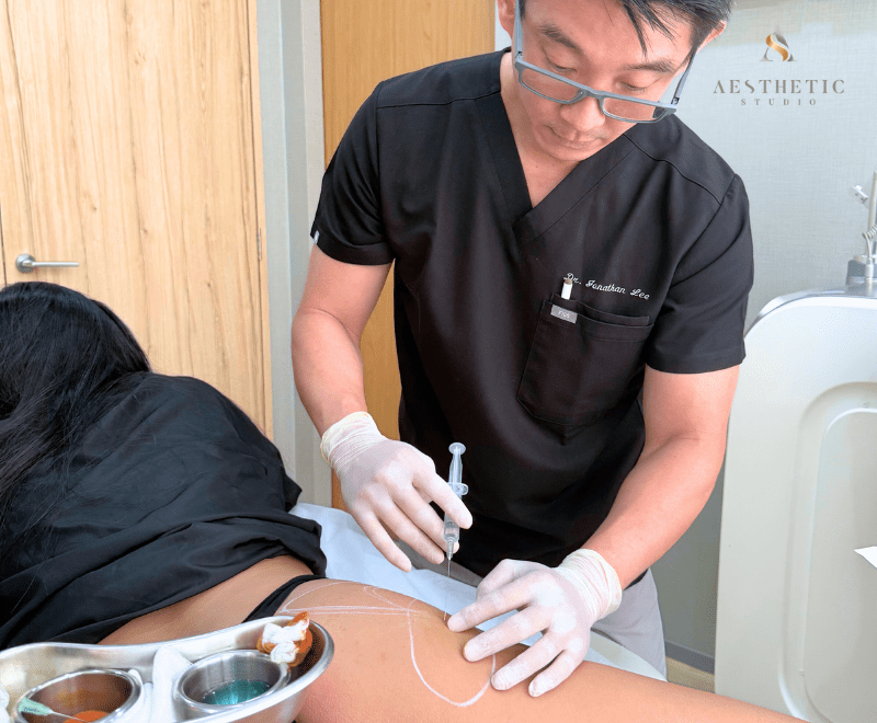 Dr Jonathan Lee performing Sculptra butt lift procedure with targeted collagen-stimulating injections