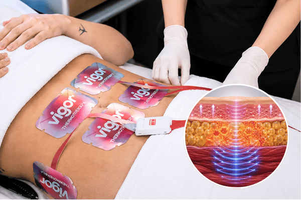 Patient undergoing Wonder Vigor body contouring treatment with abdominal treatment pads and illustration showing muscle stimulation, fat reduction and skin tightening.