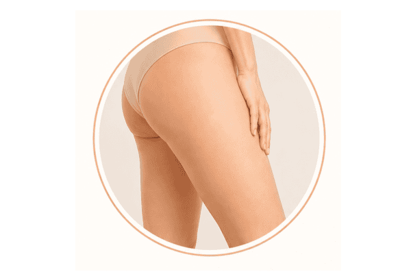 Illustration of Grade 0 cellulite showing smooth skin with no visible dimpling or skin depressions